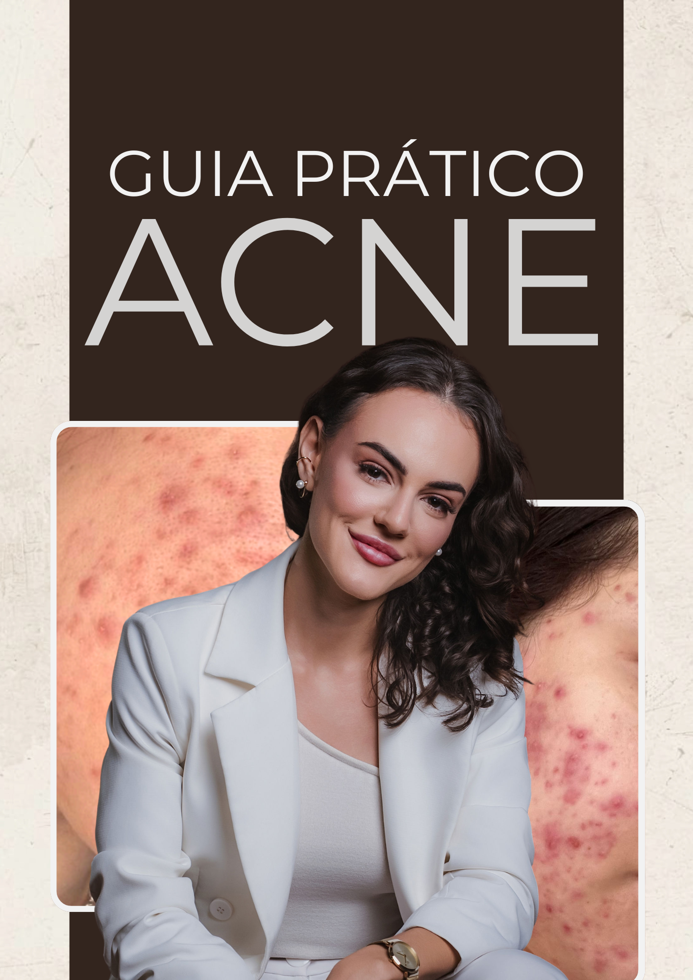 Guia Prático de Acne — capa do produto