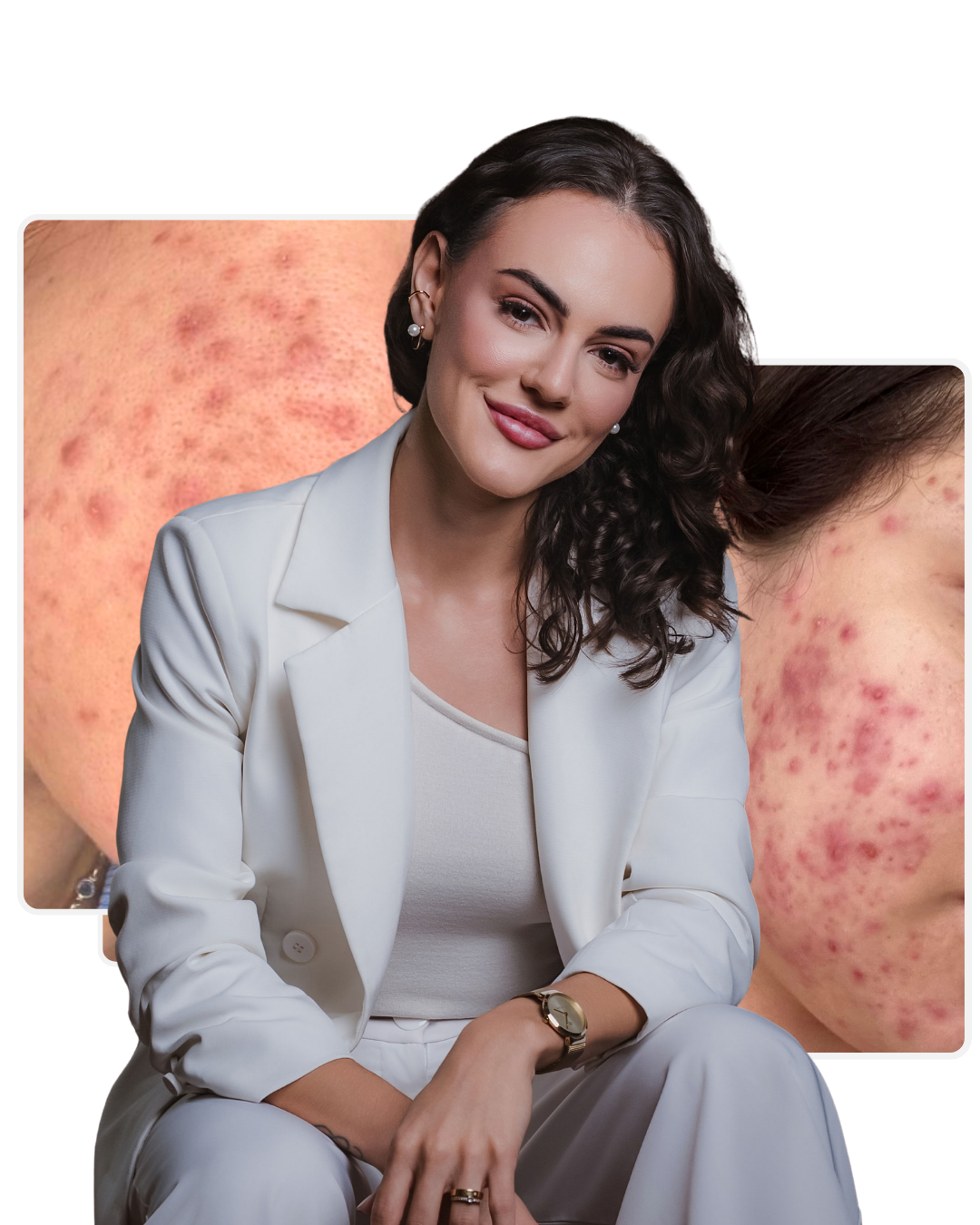 Gabi KT, especialista em estética integrativa